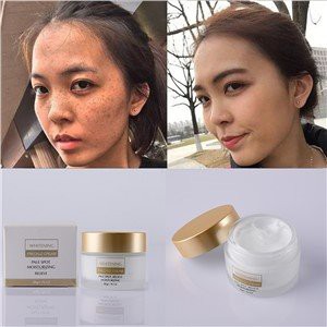 फेस फ्रील्स रिमूवल क्रीम