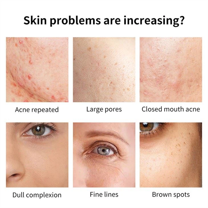 2% Salicylic Acid Face Serum
